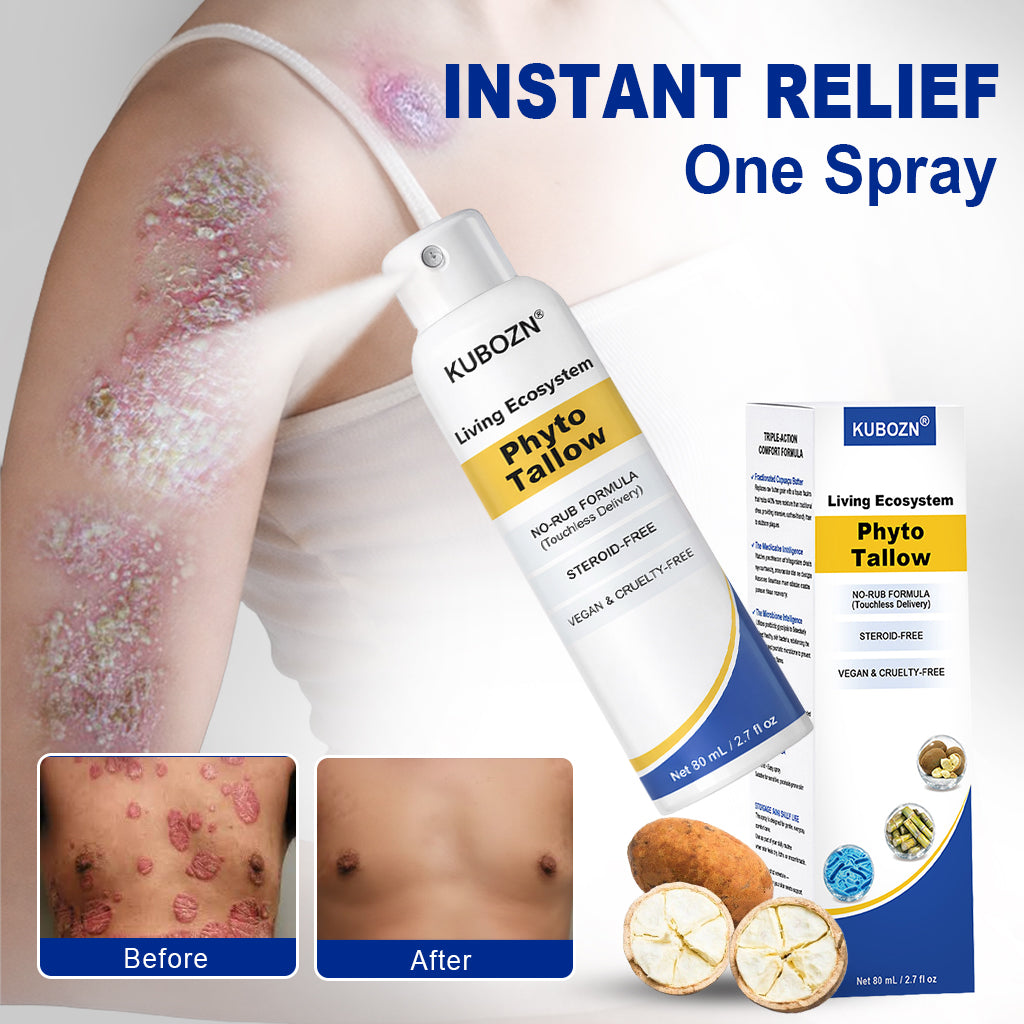 KUBOZN® Phyto Tallow Spray for Psoriasis-Prone Skin💓