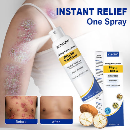 KUBOZN® Phyto Tallow Spray for Psoriasis-Prone Skin💓