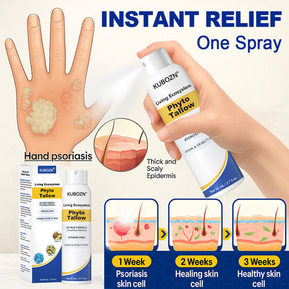 KUBOZN® Phyto Tallow Spray for Psoriasis-Prone Skin💓