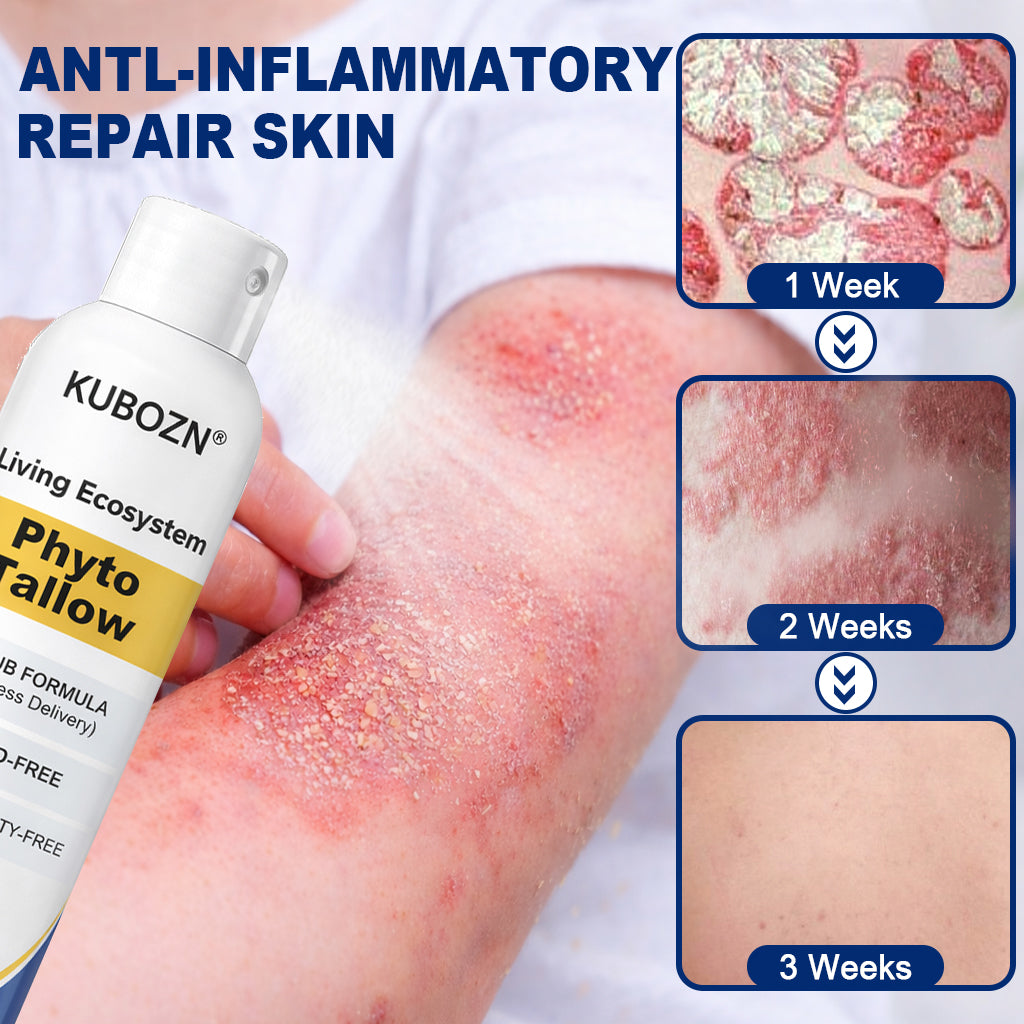 KUBOZN® Phyto Tallow Spray for Psoriasis-Prone Skin💓