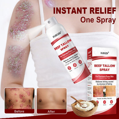 KUBOZN® Tallow Spray — The No-Rub Relief for Psoriasis-Prone Skin✨ (OFFER)