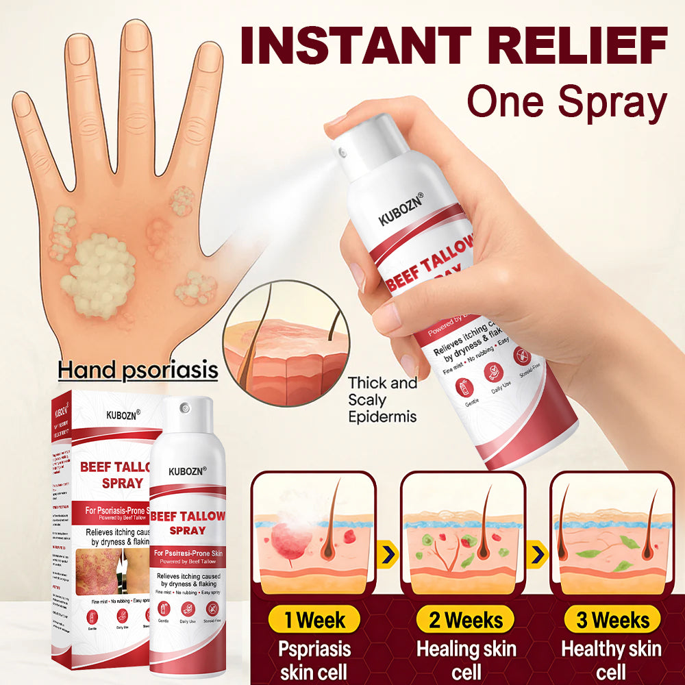 KUBOZN® Tallow Spray — The No-Rub Relief for Psoriasis-Prone Skin✨ (OFFER)