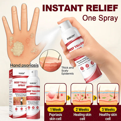 KUBOZN® Tallow Spray — The No-Rub Relief for Psoriasis-Prone Skin✨ (OFFER)